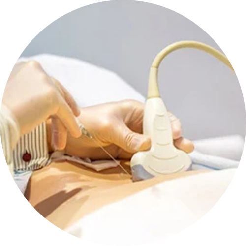 Injeksi saraf/epidural USG-guided