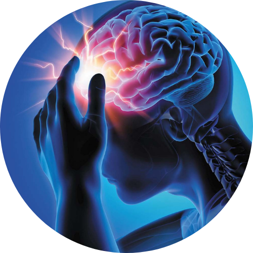 Migrain / nyeri kepala