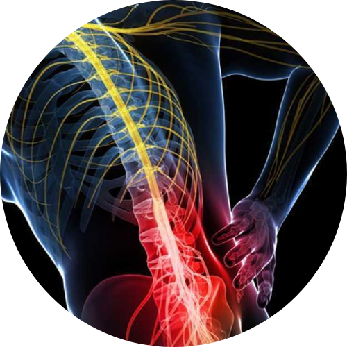 Nyeri punggung bawah